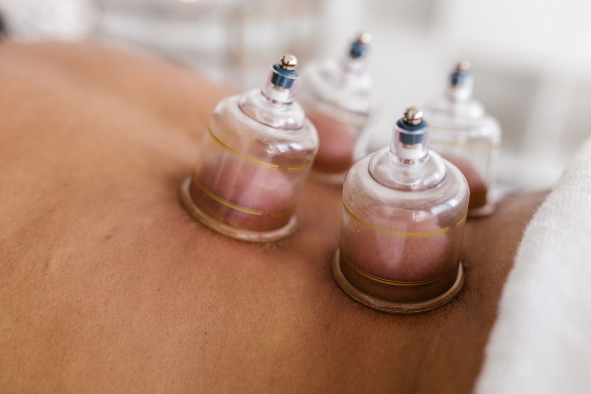 Close-up of suction cups during cupping treatment